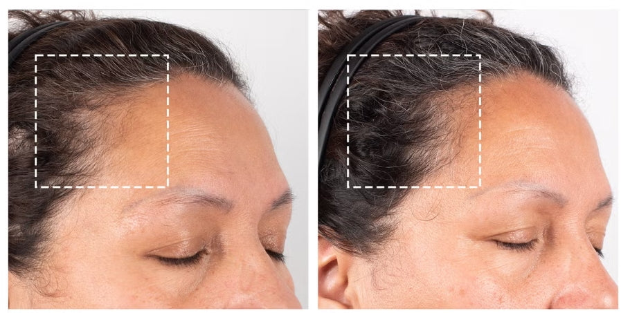 Obagi Nu-Cil BioStim Scalp Serum