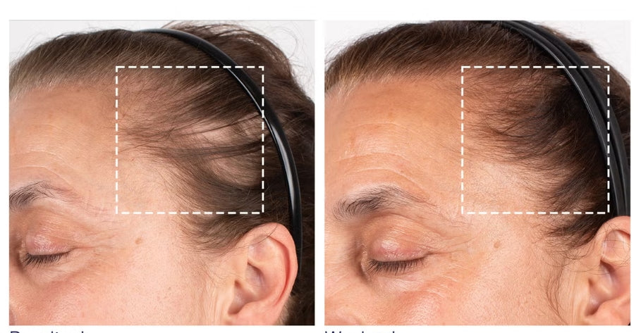 Obagi Nu-Cil BioStim Scalp Serum