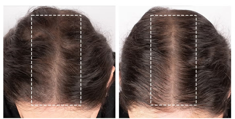 Obagi Nu-Cil BioStim Scalp Serum